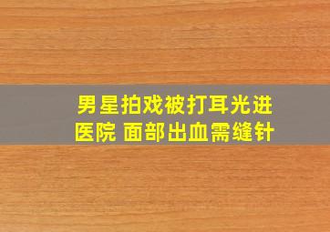 男星拍戏被打耳光进医院 面部出血需缝针